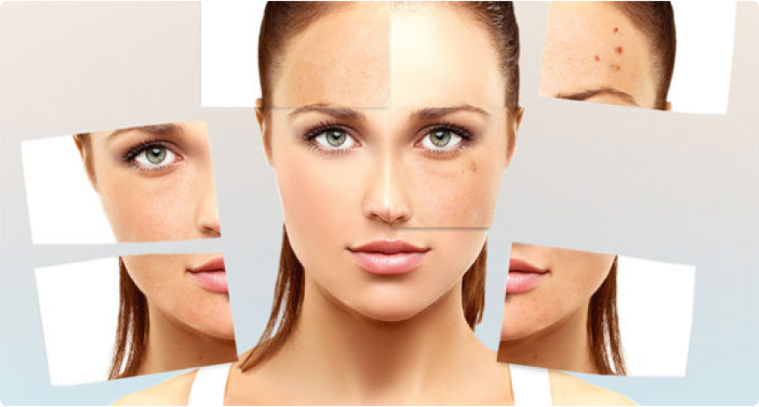 The Ben­e­fits of INUS Microneedle RF for Acne Scars?