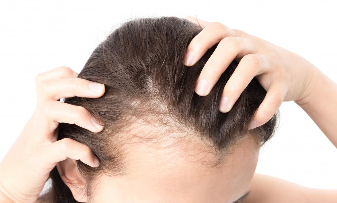 Renew Your Locks: Exploring the Effectiveness of Inus RF Microneedling for Hair Loss Solutions