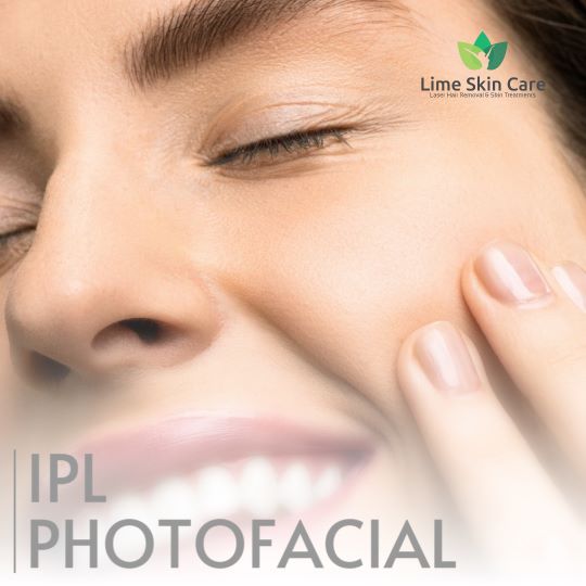 IPL Photofacial: Rejuvenate Your Skin at Lime Skin Care Hollywood, Florida