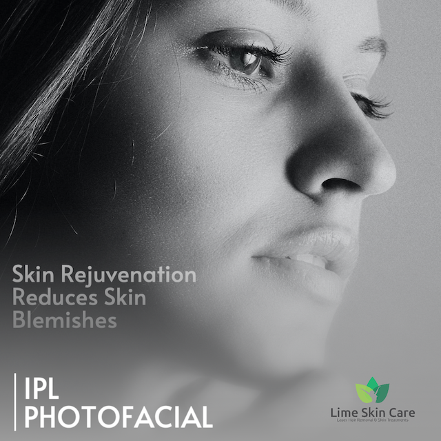 Experience Superior IPL Photofacial Treatments at Lime Skin Care, Hollywood, FL